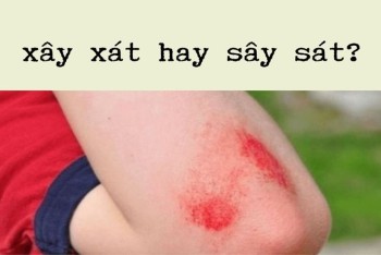 Xây xát hay sây sát đúng chính tả? Nên dùng từ nào phù hợp?